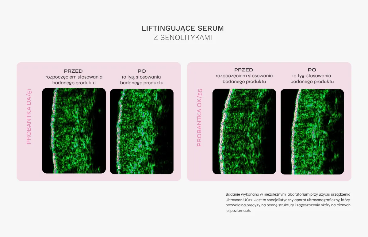 Wyniki badań serum liftingujące z senolitykami